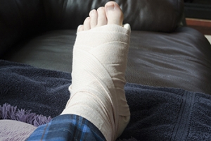 Bearing Weight on a Broken Foot