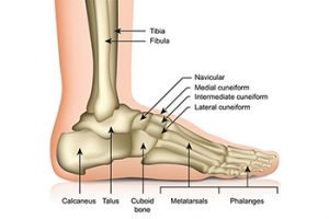 What Is Sinus Tarsi Syndrome?