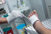 Foot Ulcers and Diabetes
